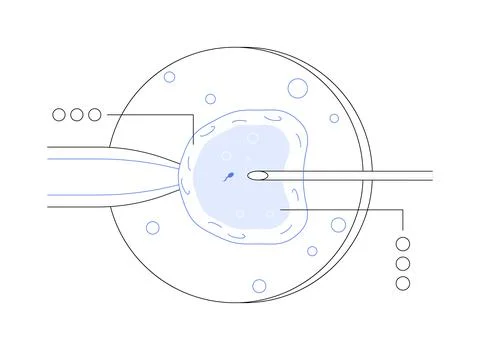 In vitro fertilization abstract concept vector illustration. Stock Illustration