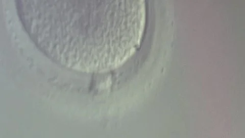 In Vitro Fertilization 스톡 동영상 302075337