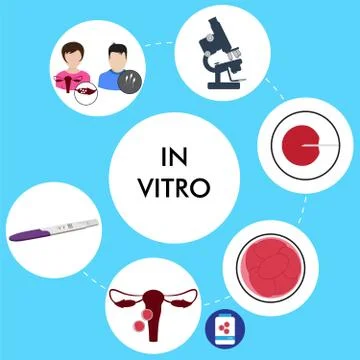 In vitro fertilization Stock Illustration