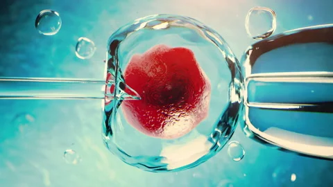 In vitro fertilization or artificial insemination procedure Stock Footage 307325148