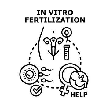 In vitro fertilization procedure helping couples conceive Stock Illustration