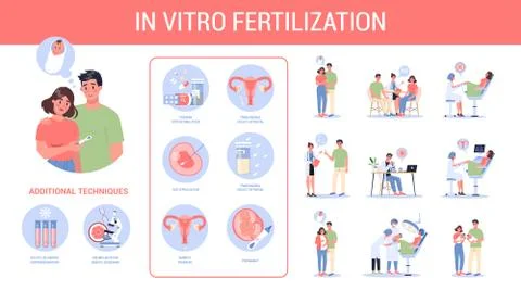 In vitro fertilization step-by-step method. Idea of infertility Illustrazione stock