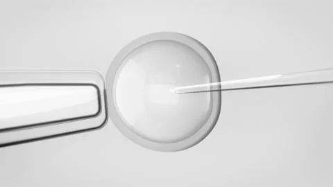 In vitro fertilization. View from a microscope. Loopable. IVF. Video stock 160496571