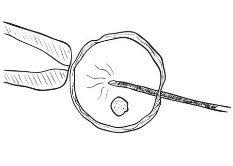 In vitro insemination drawing Stock Illustration
