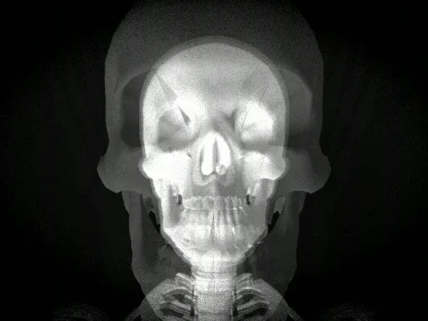 VJ Loop Skeleton a mr Stock Footage 376978