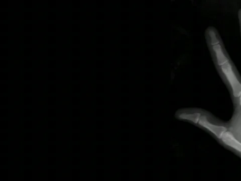 VJ loop xRay Hand mr Stock Footage 456885