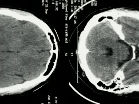 VJ loop Xray Head mr Vidéo 456888