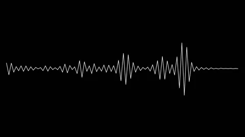 Voice Sound Graph, Pulse Of Track Playing, Audio Technology Background Stock Footage 158174048