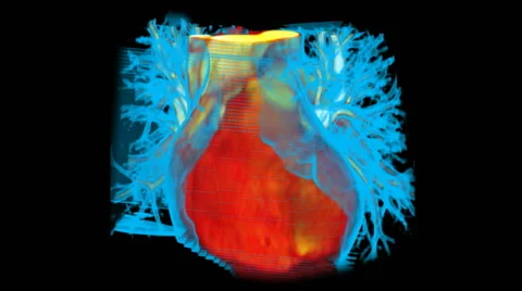 Volume Rendering of Beating Heart with Lung Tissue Stock-Footage 64822906