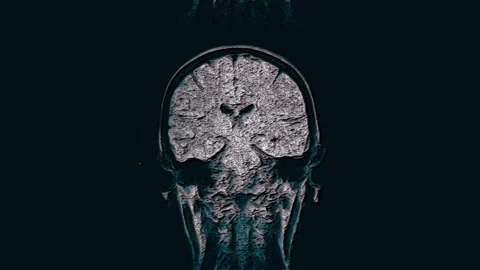 Voluminous color MRI brain, head scans and tumor detection. Diagnostic medical Stock Footage 139260314