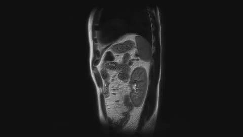 Voluminous CT scan of the abdomen. Computed tomography of the gastrointestinal Stock Footage 199024088