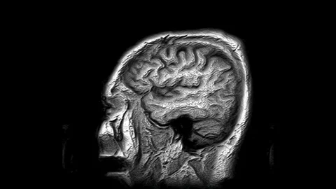 Voluminous MRI scans of the brain and head to detect tumors. Diagnostic medical Stock-Footage 122748744