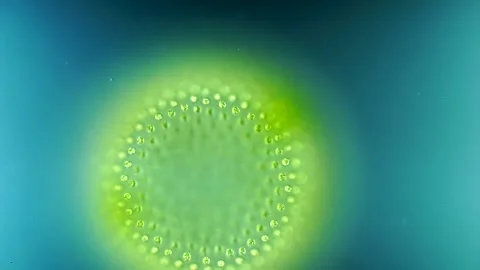 Volvox colony under DIC microscopy Stock Footage 315725465