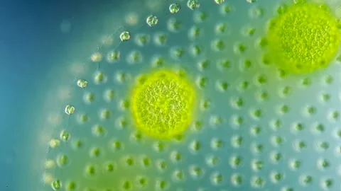 Volvox colony under DIC microscopy 40x lens Stock Footage 319075810