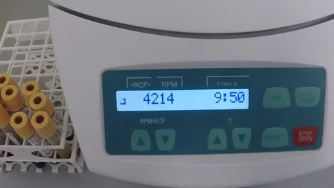 Vortex mixer is working in bio lab 스톡 동영상 76580370