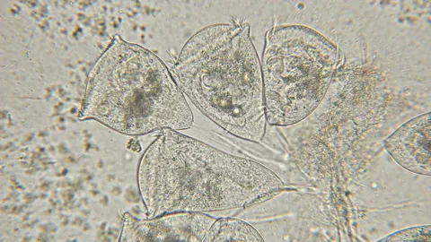 Vorticella colony under a microscope, a genus of ciliates, leads a single or Stock Footage 128386952