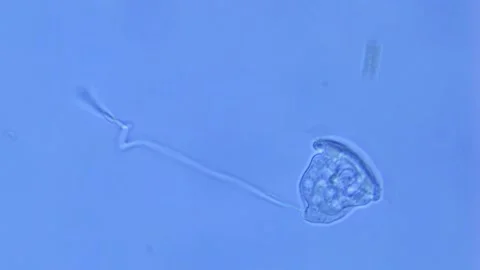 Vorticella contraction under microscope-400x Stock Footage 302709132