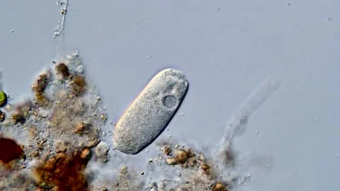 Vorticella genus under microscope view Vidéo 310383427