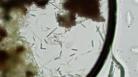Vorticella sp. under brightfield microscopy at 20x Stock Footage 334062418