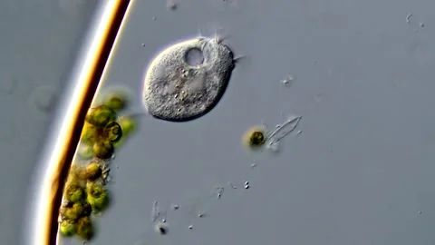Vorticella under the microscope Vidéo 310356714