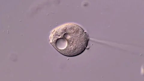 Vorticella under the microscope 库存影片 310641983