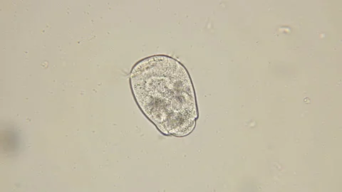 Vorticella under a microscope, a genus of ciliates, leads a single or colonial Stock Footage 128389321