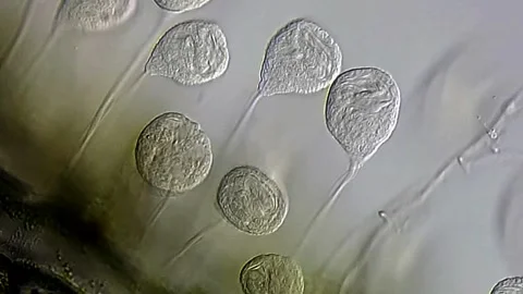 Vorticella under microscope view 400x magnification Vídeos de archivo 306585828