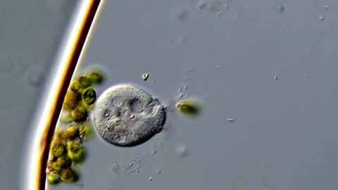 Vorticella under microscope view 400x magnification 库存影片 310356530