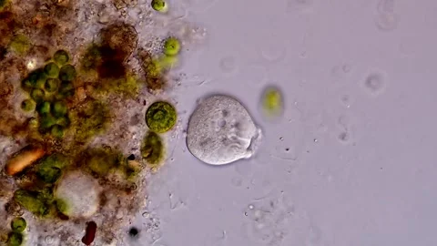 Vorticella under microscope view 400x 库存影片 310356551