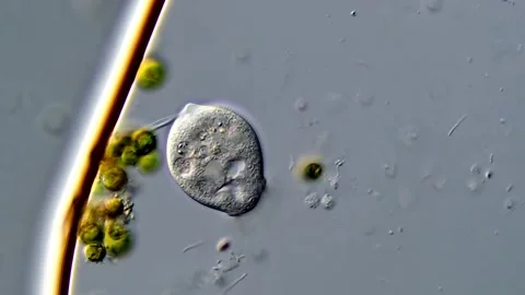 Vorticella under microscope view, 400x magnification Vídeos de archivo 310356724