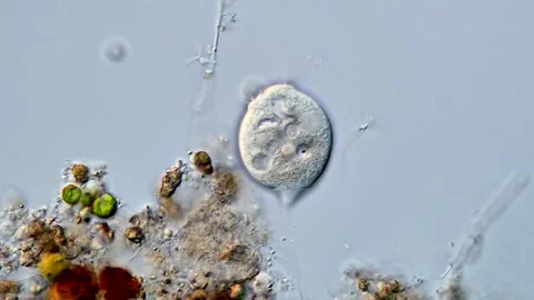Vorticella under microscope view 400x 스톡 동영상 310386387