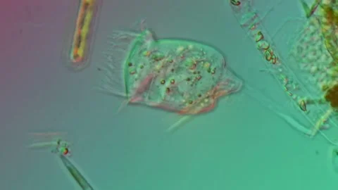 Vorticellidae Ciliate in DIC Microscopy at 50x, Microscopic Video Stock Footage 334701089