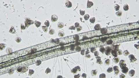 Vorticellidae colony on the Lemna root. Image from optical microscope with 10x Stock Footage 244865355