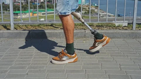 Walking with a prosthetic leg along the riverside path on a sunny day Stock Footage 287190898