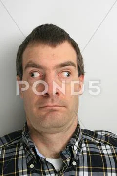 Walleyed man Stock Photos