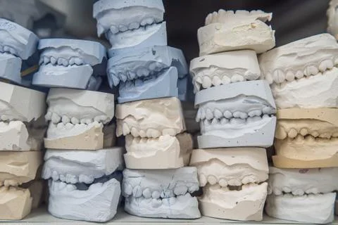 Warehouse of plaster models of human jaws in an orthodontic clinic. Control a Stock Photos