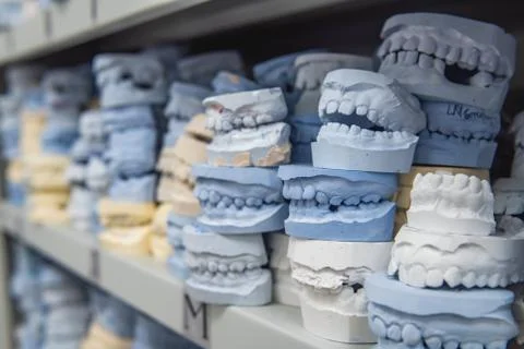 Warehouse of plaster models of human jaws in an orthodontic clinic. Control a Stock Photos