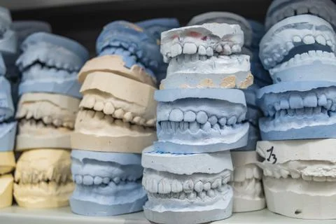 Warehouse of plaster models of human jaws in an orthodontic clinic. Control a Stock Photos