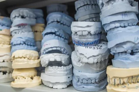 Warehouse of plaster models of human jaws in an orthodontic clinic. Control a Stock Photos