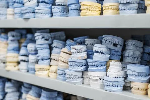Warehouse of plaster models of human jaws in an orthodontic clinic. Control.. Stock Photos