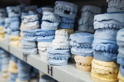 Warehouse of plaster models of human jaws in an orthodontic clinic. Control.. Stock Photos