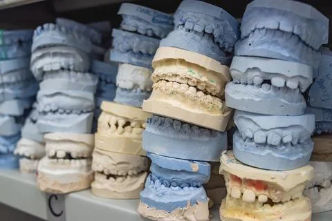 Warehouse of plaster models of human jaws in an orthodontic clinic. Control.. Stock Photos