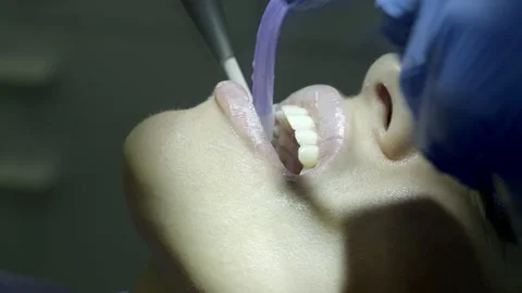 Washing teeth at the dentist Video stock 149262594