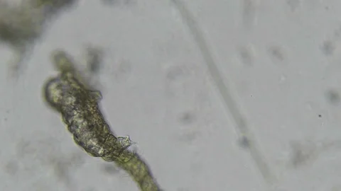 Water Bear - Microscopy video of Tardigrade on moss Stock Footage 175213791