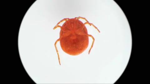 Water mite-Hydrachnidia under a microscope Stock Footage 90762290
