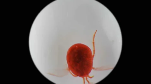 Water mite-Hydrachnidia under a microscope Stock Footage 90762773