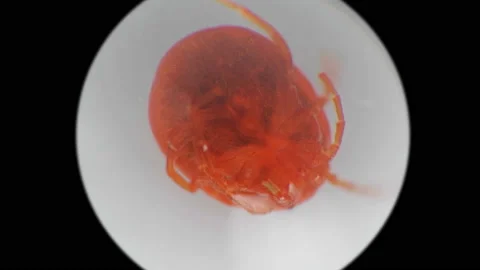 Water mite-Hydrachnidia under a microscope Stock Footage 90762834