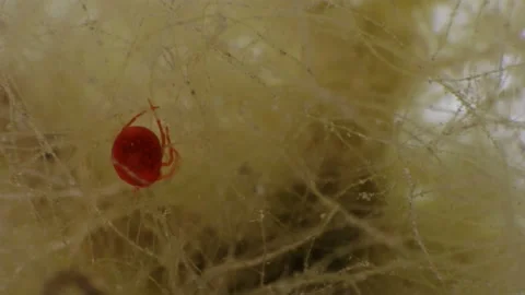 Water mite-Hydrachnidia under a microscope Stock Footage 91034426