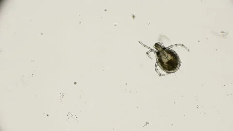 Water mite in motion, under a microscope Stock Footage 91958013