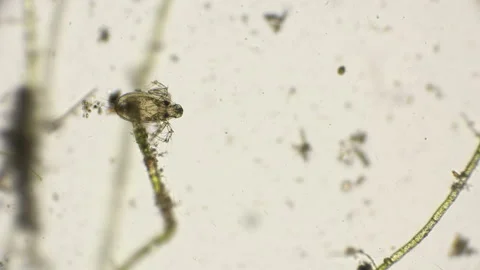 Water mite under a microscope Stock Footage 93581558